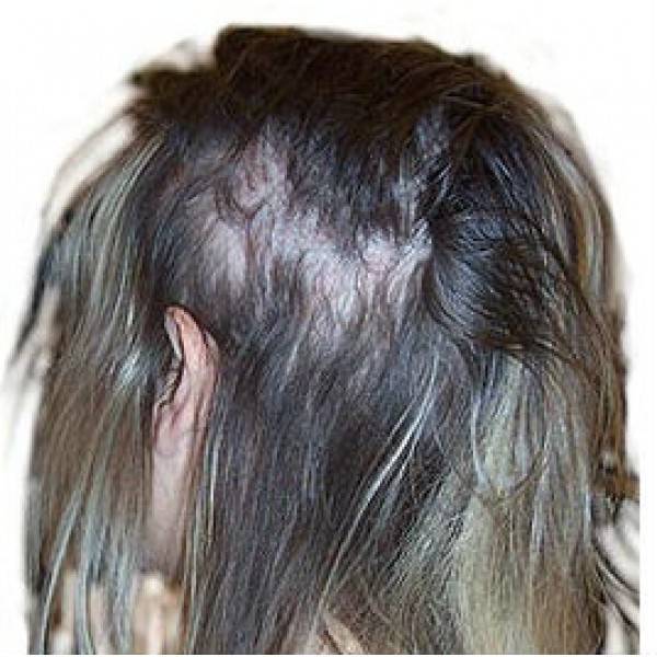 Восстановление волос: полный гид от all things hair