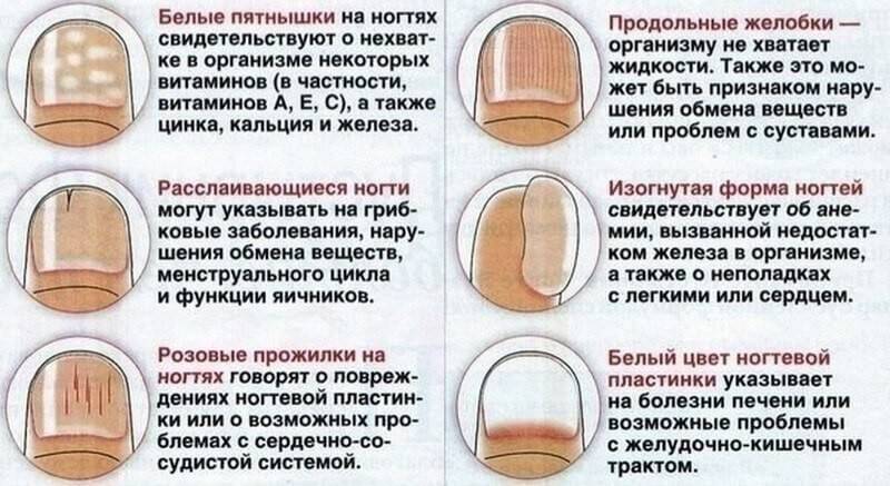 Оценка линий ногтей: цвет и вид - ключи к диагностике | дерматология в россии