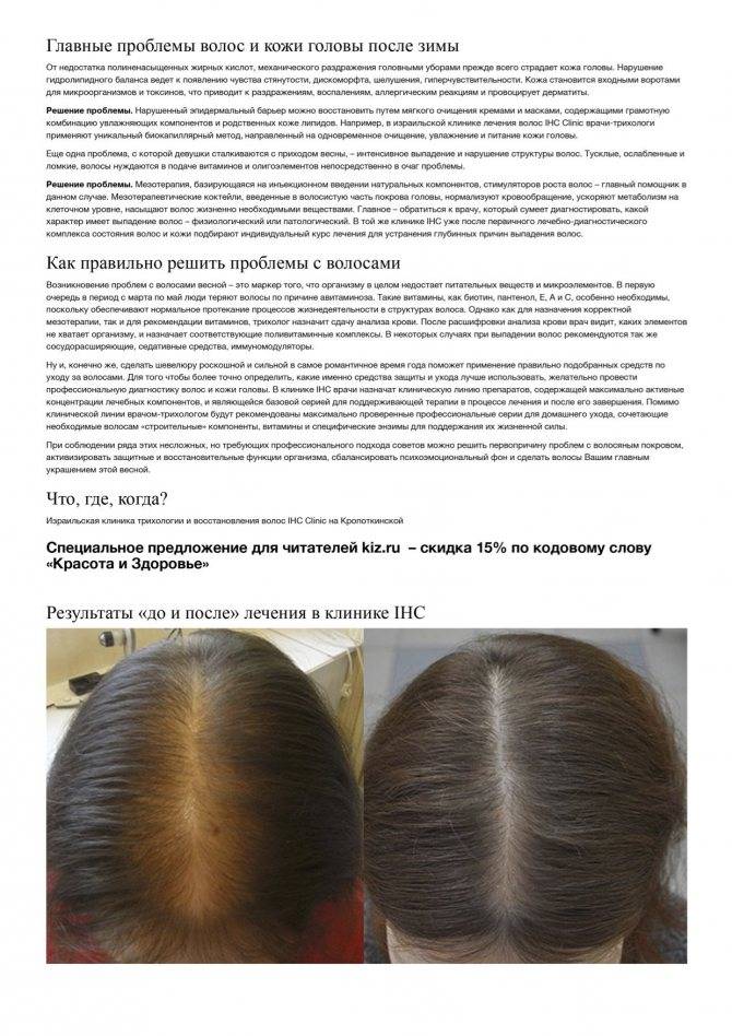 Гормоны и выпадение волос — лечение гормонального выпадения волос у женщин - клиника «доктор волос»