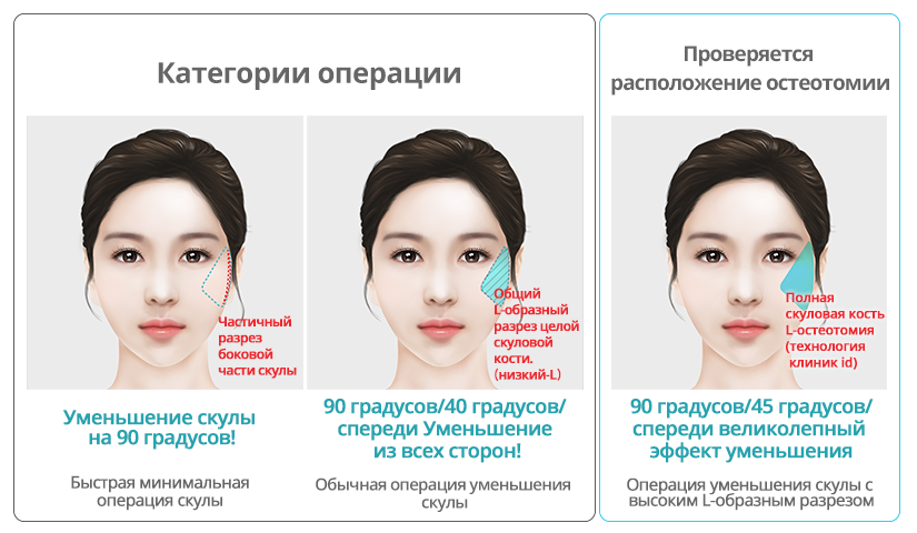 Как сузить широкое лицо, выступающие скулы. Пластика, упражнения