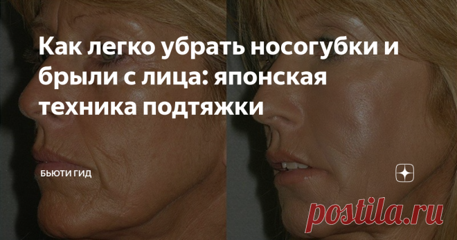 Брыли на лице: как их убрать и что это такое, фото, отзывы о гимнастике, подтяжке, филлерах, мезонитях и других методах