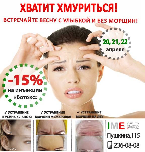 Морщины вокруг рта: 5 способов борьбы с кисетными морщинами в домашних условиях