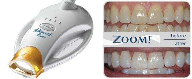 Отбеливание зубов zoom-4