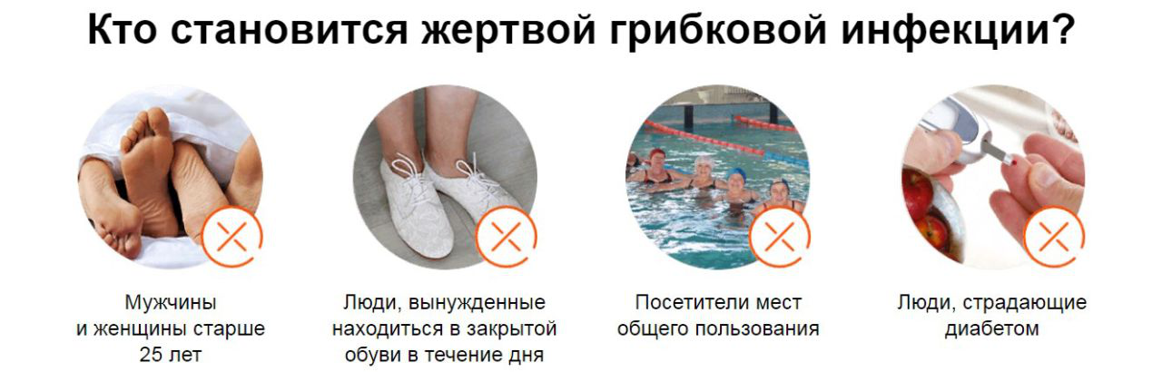 Грибковые инфекции кожи: диагностика и лечение
