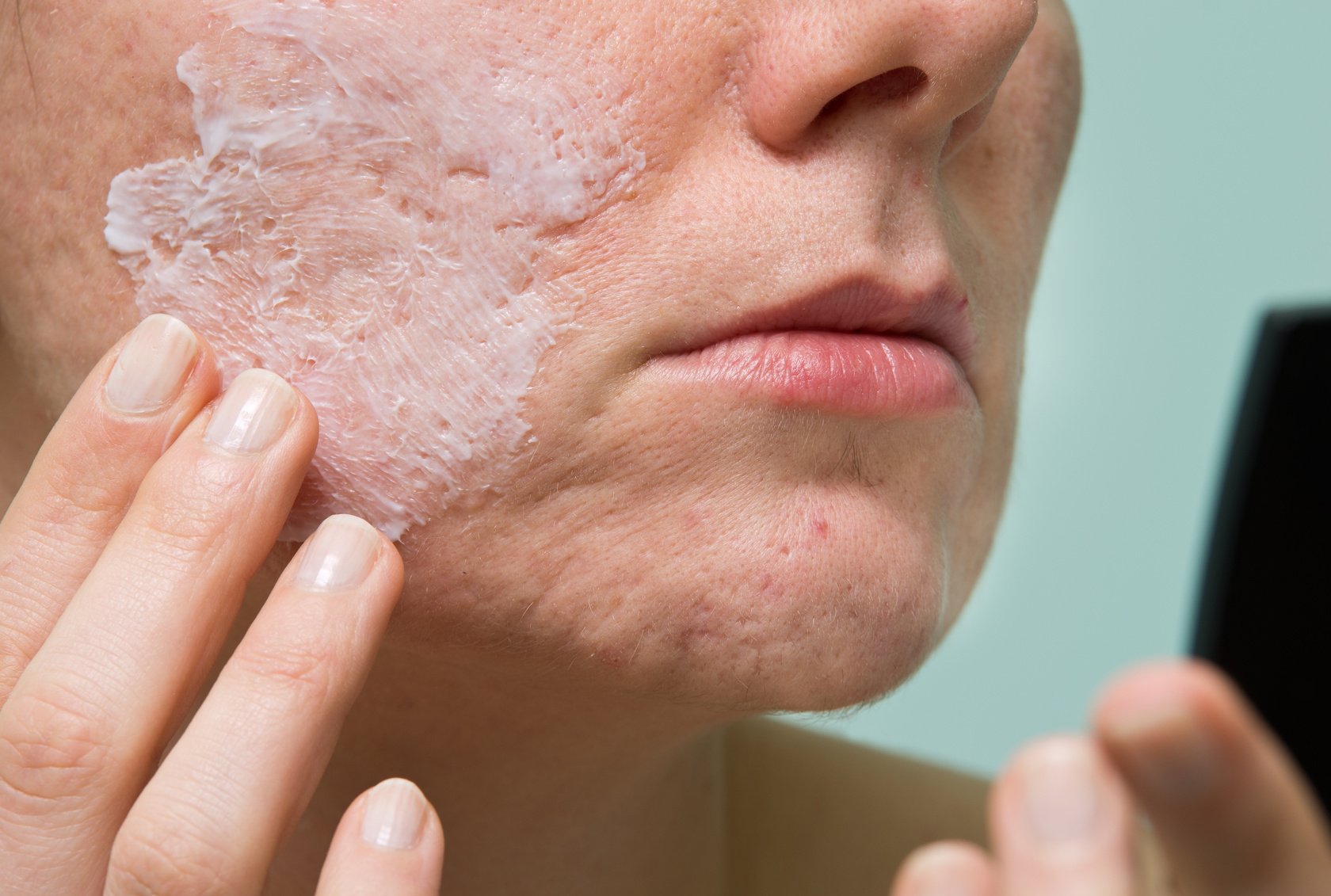 Сухая кожа: причины сухости и лечение