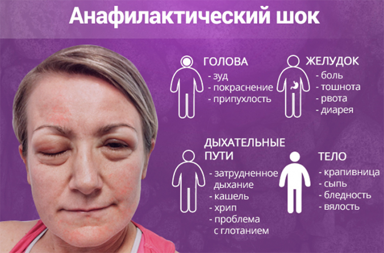 Покраснение кожи лица – классификация, причины (физические, патологические), лечение, средства от покраснения, фото