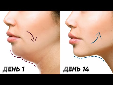 Как эффективно убрать брыли на лице в домашних условиях или в салоне