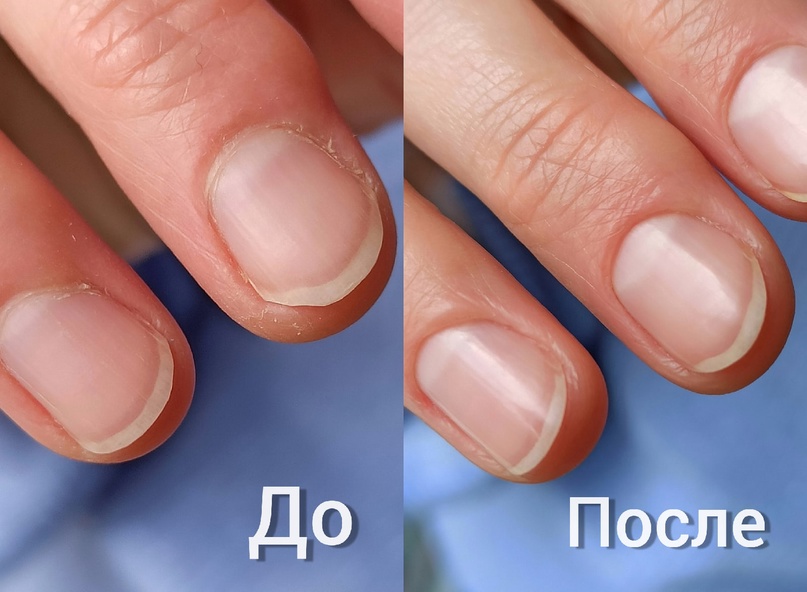 Что такое ламинирование ногтей: основные принципы процедуры и ее преимущества