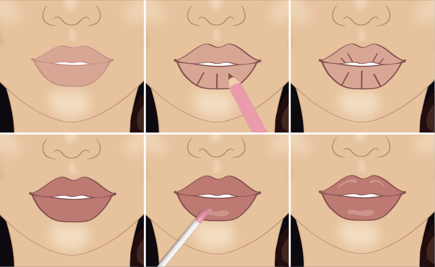 Процедура по увеличения губ техники и результаты. фото - косметология доктора корчагиной