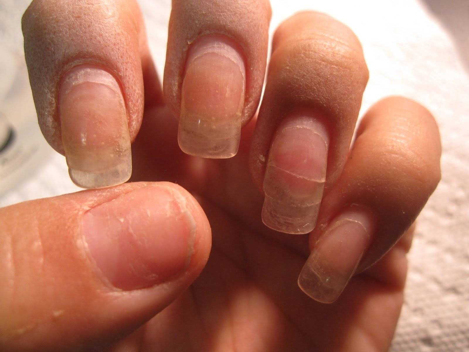Как восстановить ногти после наращивания: все способы здесь!