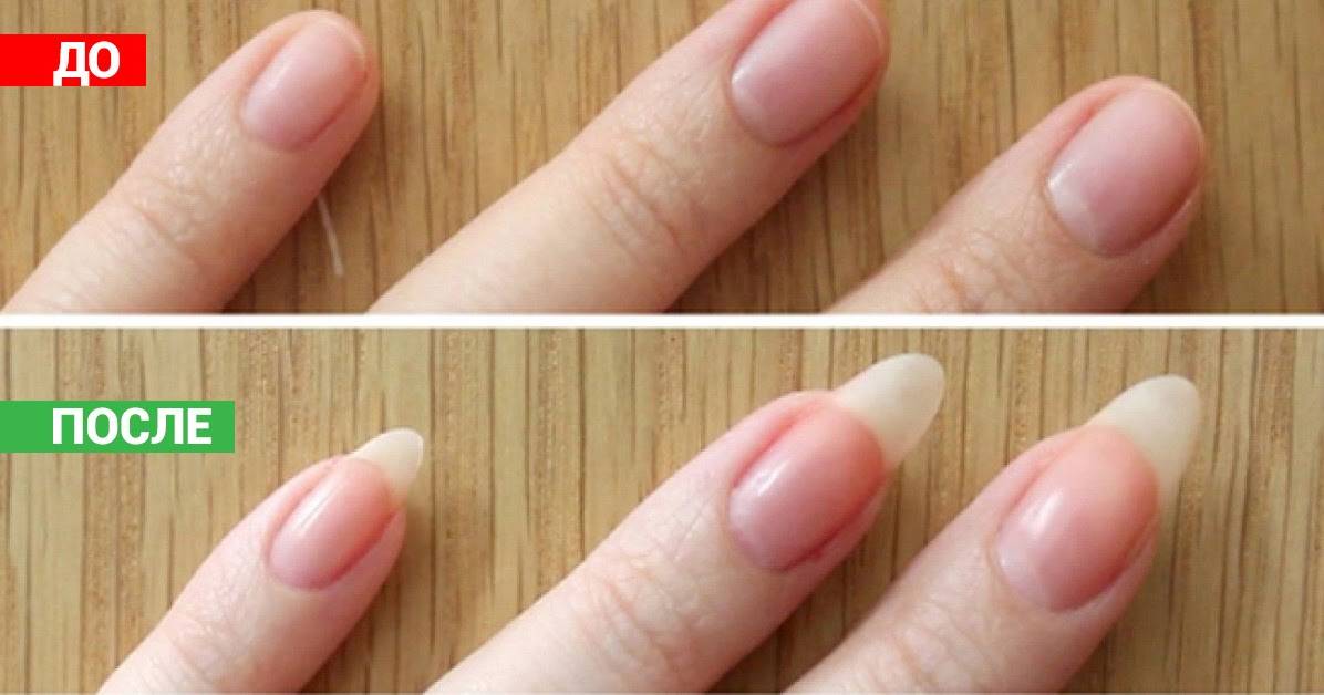 Ускоренный рост ногтей - как быстро отрастить ногти на руках в домашних условиях | маникюриста