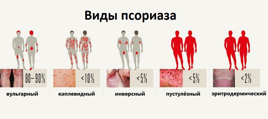 Дерматит на лице: виды, причины, симптомы, лечение в домашних условиях