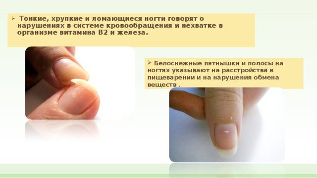 Почему ломаются и слоятся ногти: причины и лечение. что делать, если слоятся ногти на руках и ногах в домашних условиях - medside.ru