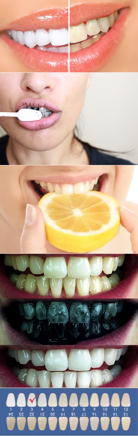 рецепты для отбеливания зубов в домашних условиях