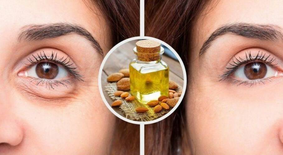 Какие масла от морщин у глаз самые эффективные