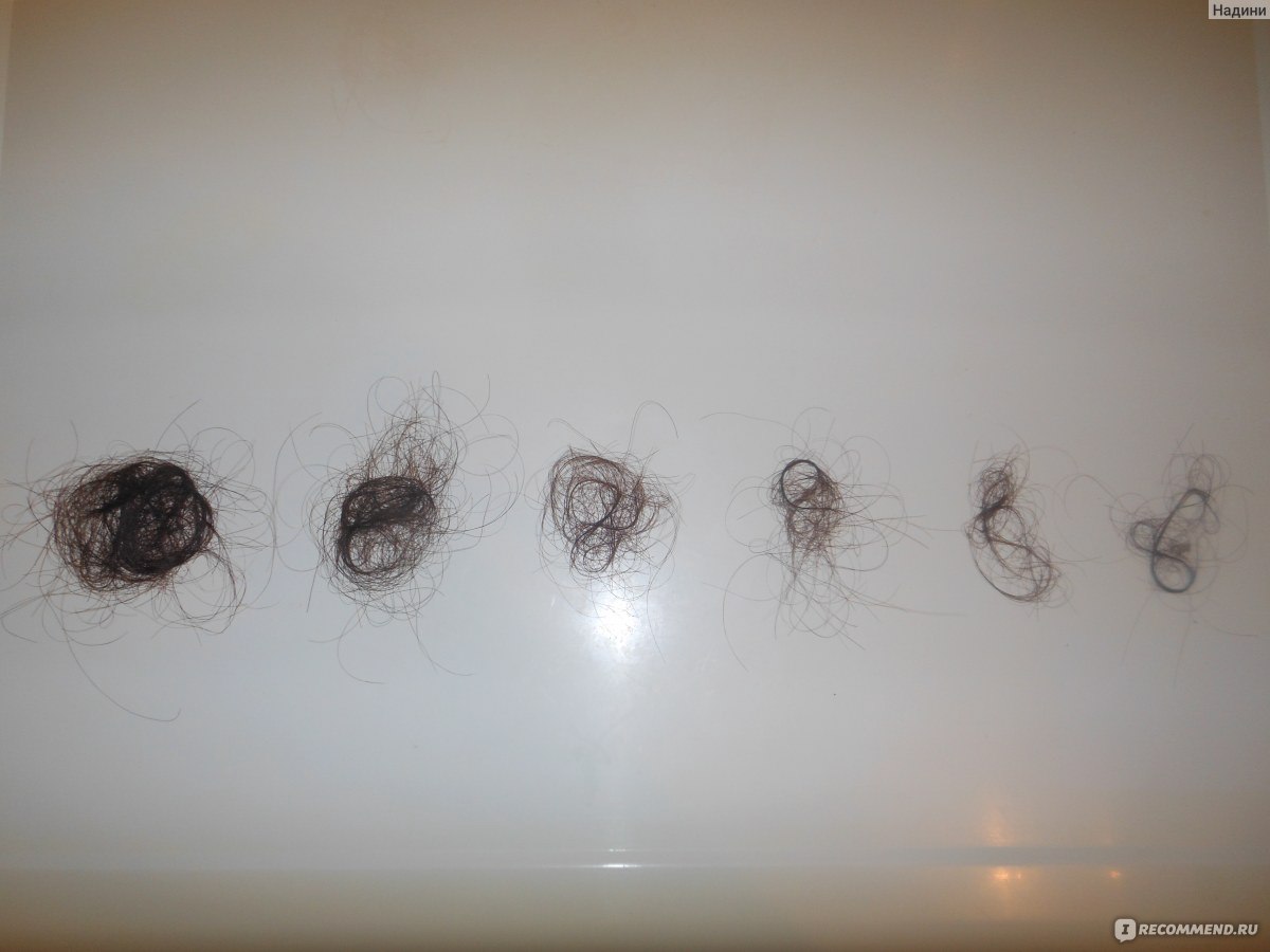 Сколько должно выпадать волос в норме?
