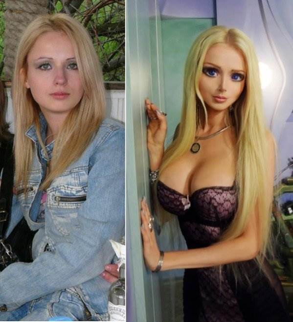 Валерия лукьянова, фото до и после операции девушки барби (amatue 21)