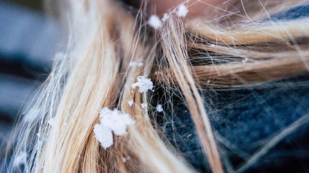 Уход за волосами зимой. как ухаживать за волосами в зимнее время?