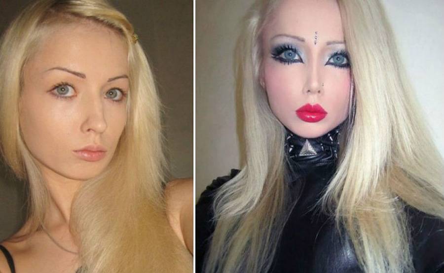 Лукьянова валерия до и после пластики. фото девушки барби (аматуе) в инстаграм, вконтакте