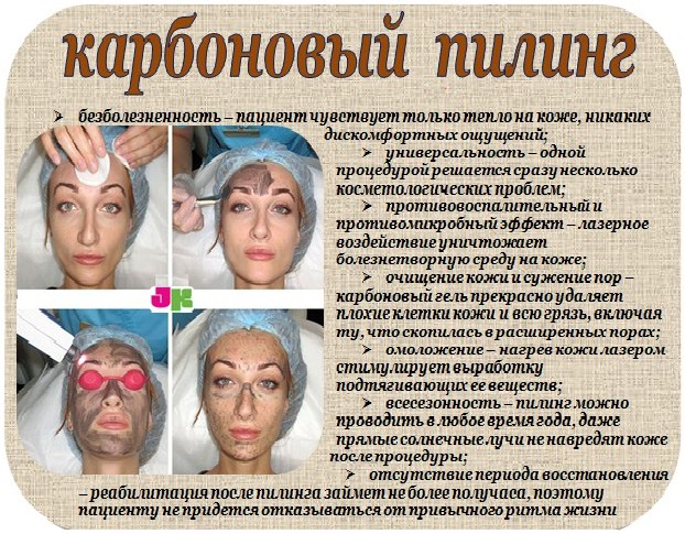 Карбоновый пилинг - общая информация, показания, противопоказания, отзывы