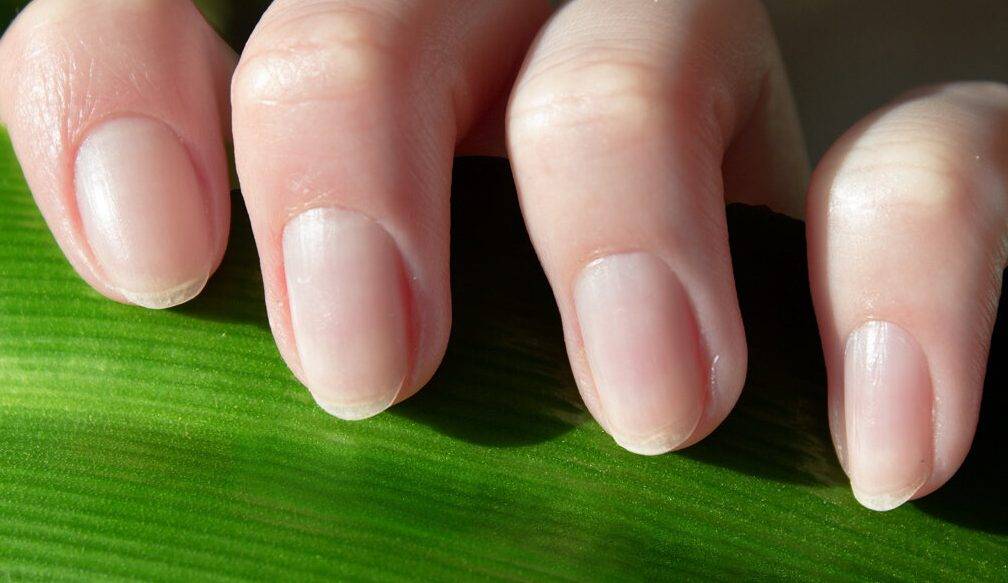 Как выглядят здоровые ногти: 5 основных признаков | красивые ногти - дополнение твоего образа