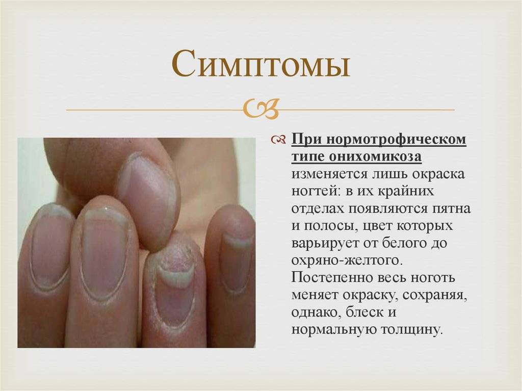 Болезни ногтей, описание и симптомы, современные методы лечения