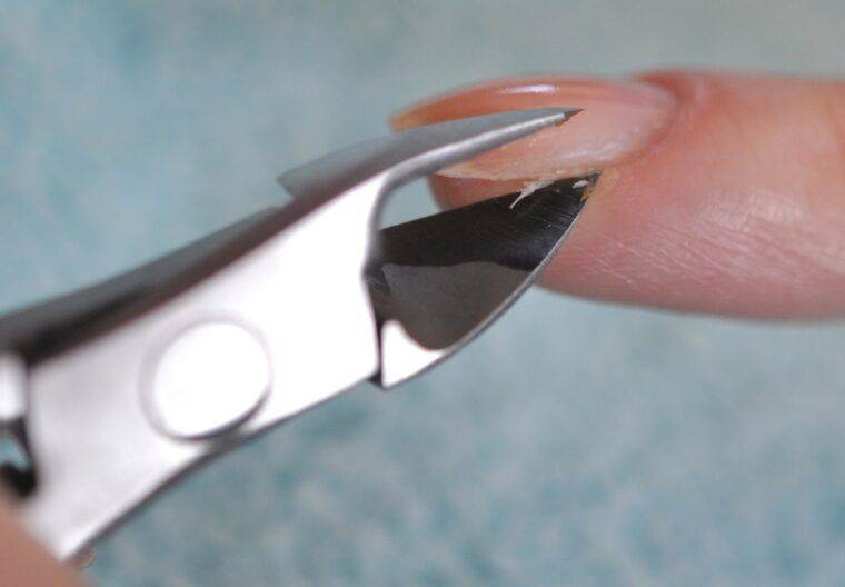 Заусенцы на пальцах: как избавиться от проблемы навсегда + меры профилактики -фото — модный дизайн ногтей