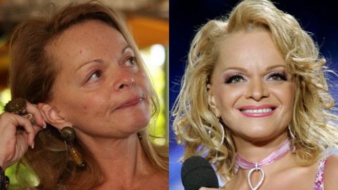 Фото российских знаменитостей и голливудских звезд до и после пластики