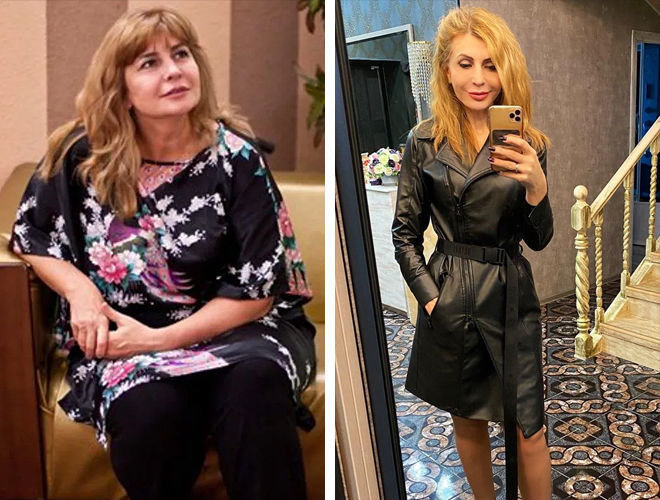 Ирина агибалова до и после операции пластики, похудения. фото
