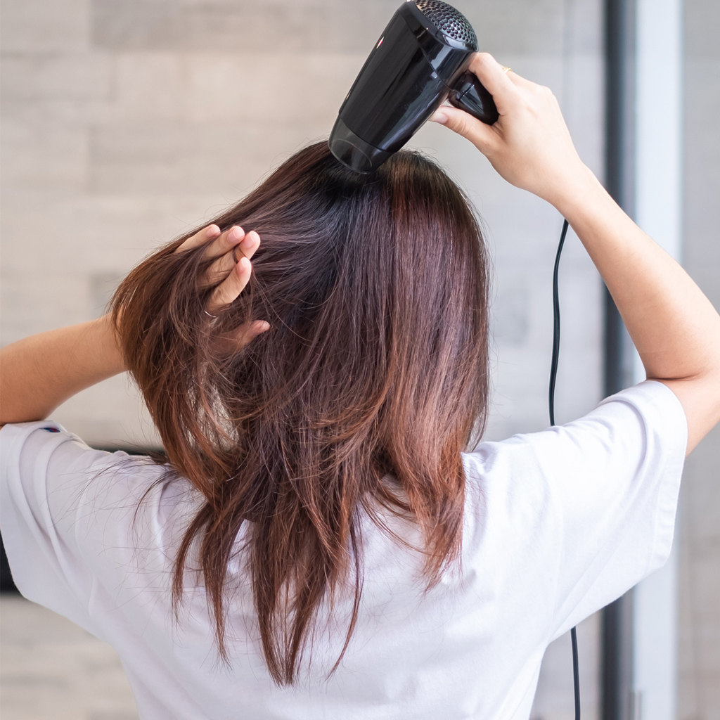 Алопеция, или выпадение волос. причины выпадения волос и типы облысения