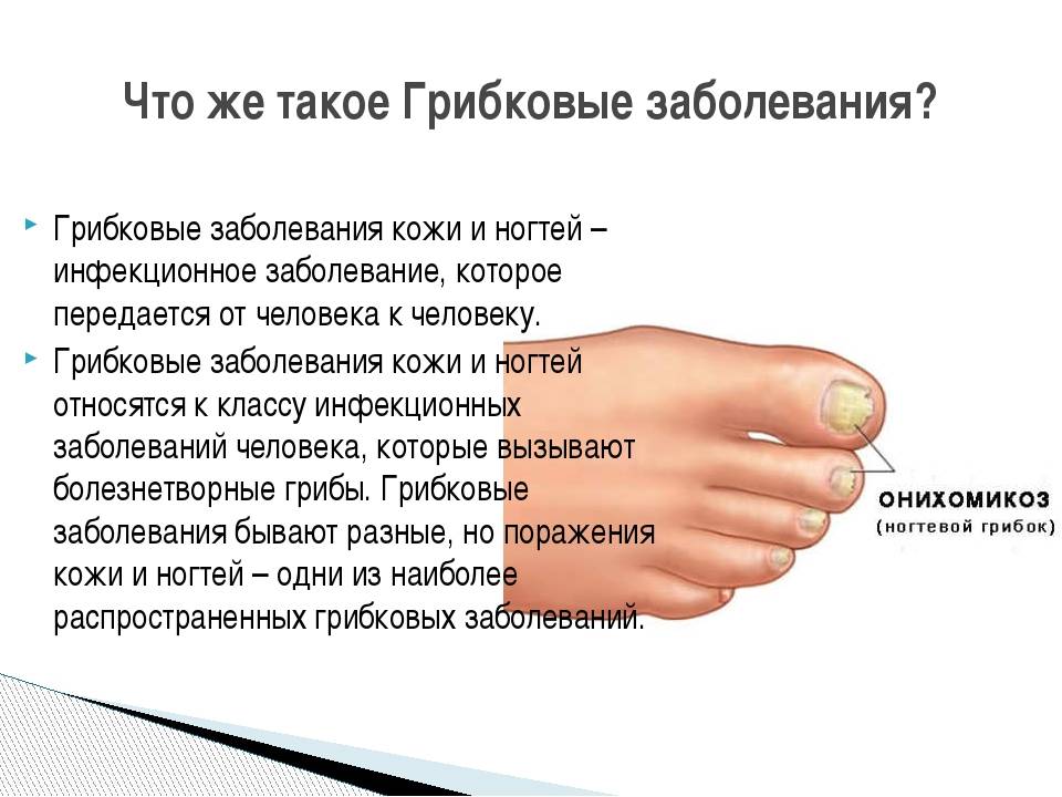Онихолизис ногтей на руках: лечение, препараты, отзывы – эл клиника