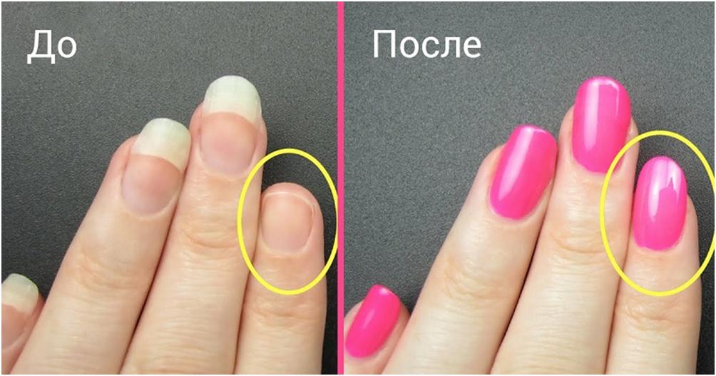 Поломка ногтя: что делать?