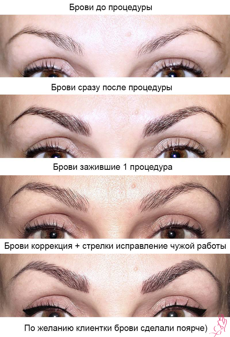 Коррекция перманентного макияжа бровей. как происходит заживление, уход