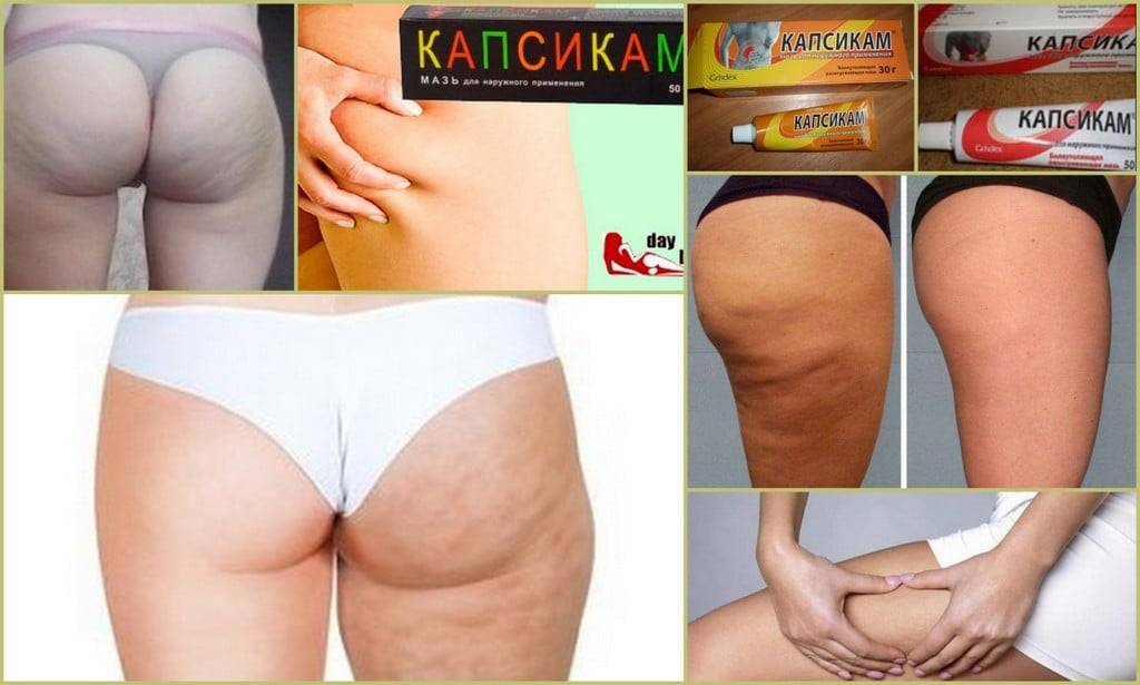Самые эффективные рецепты антицеллюлитного обертывания в домашних условиях