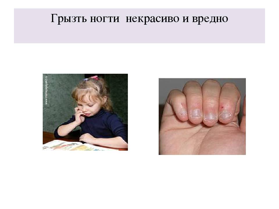 Почему люди грызут ногти: причины, психология