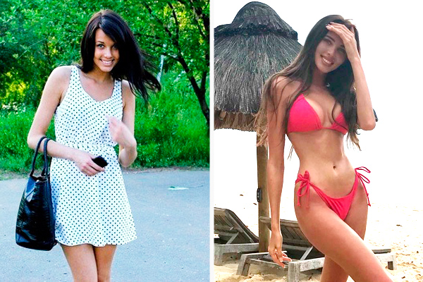 Российские знаменитости до и после пластики 23 фото