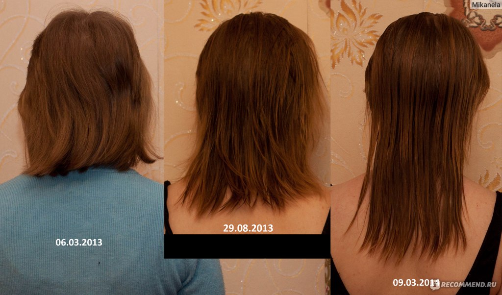 На сколько сантиметров отрастают волосы в месяц и в год?