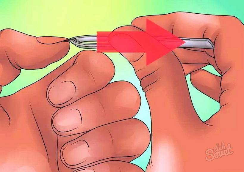 Как вытащить занозу из волоса