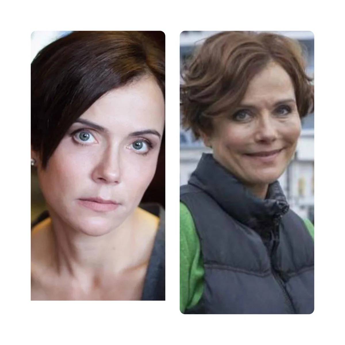 Российские актрисы до и после пластики лица. Фото