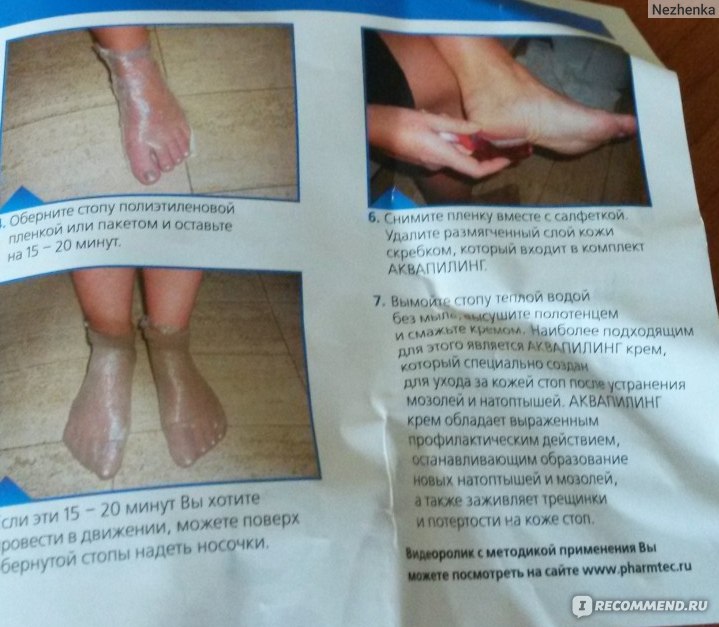 Аквапилинг для ног: отзывы о креме-пасте от натоптышей, инструкция по применению раствора, средство фармтек, состав мази