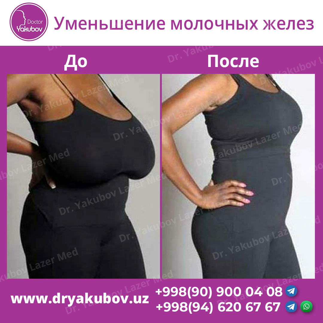 упражнения для уменьшение груди для женщин фото 47
