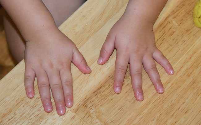Вредные привычки. ребенок грызет ногти. | центр аналитической психологии