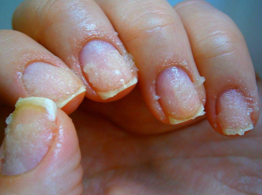 Как восстановить ногти после наращивания в домашних условиях - полезные советы