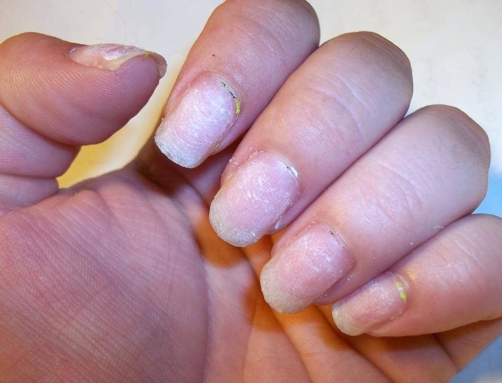 Как восстановить ногти после снятия гель-лака