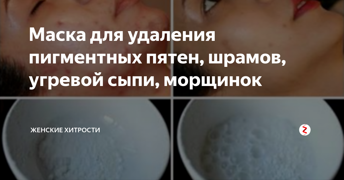 Как отбелить лицо в домашних условиях быстро: выбираем крем от пигментных пятен и рецепты масок | moninomama.ru