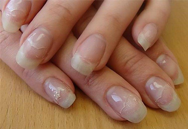 Восстанавливаем ногти после наращивания дома