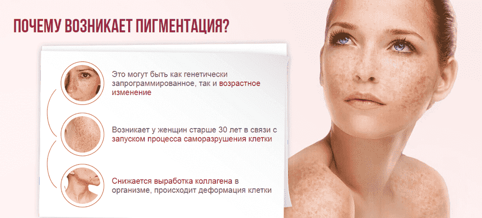 Как удалить пигментные пятна на лице в блоге evo laboratoires