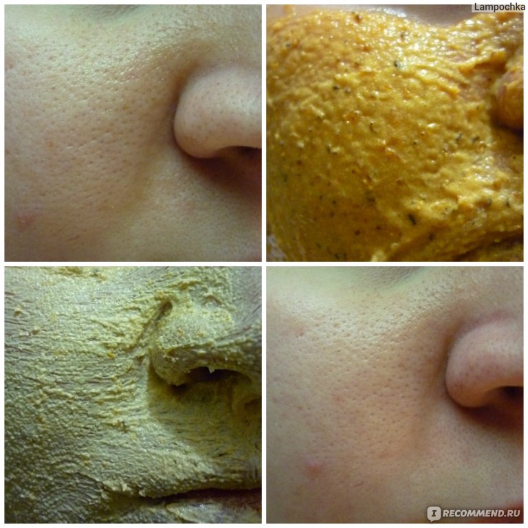 Как избавиться от шелушения на лице и коже в домашних условиях
