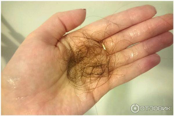 Сколько волос должно выпадать при мытье головы?