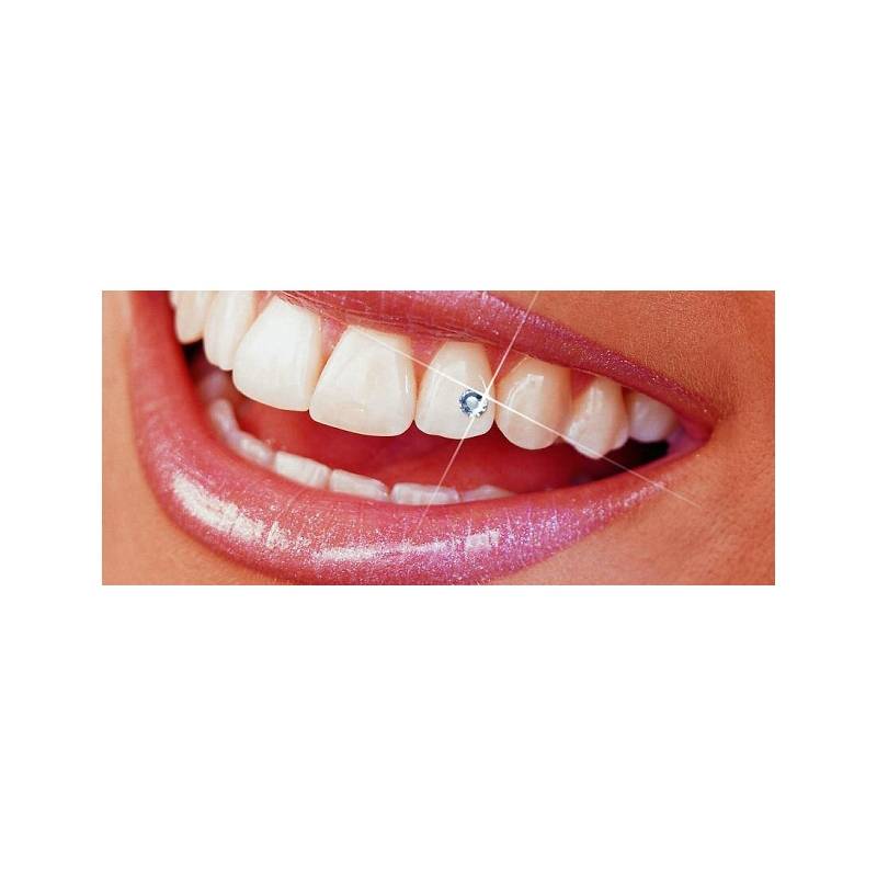 Украшения на зубы: грилзы, скайсы, twinkles
